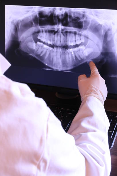 Best Emergency Dental Extractions in Smithville Sanders, IN