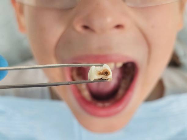 Best Urgent Dental Care for Toothache in Smithville Sanders, IN